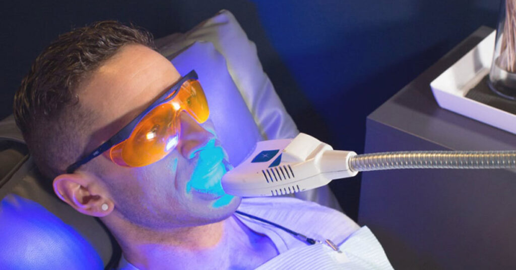 بلیچینگ 6 Everything You Need to Know Before Your First Teeth Whitening Treatment