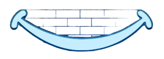 روکش طلای دندان 2 photo 2024 07 22 18 30 05 prev ui