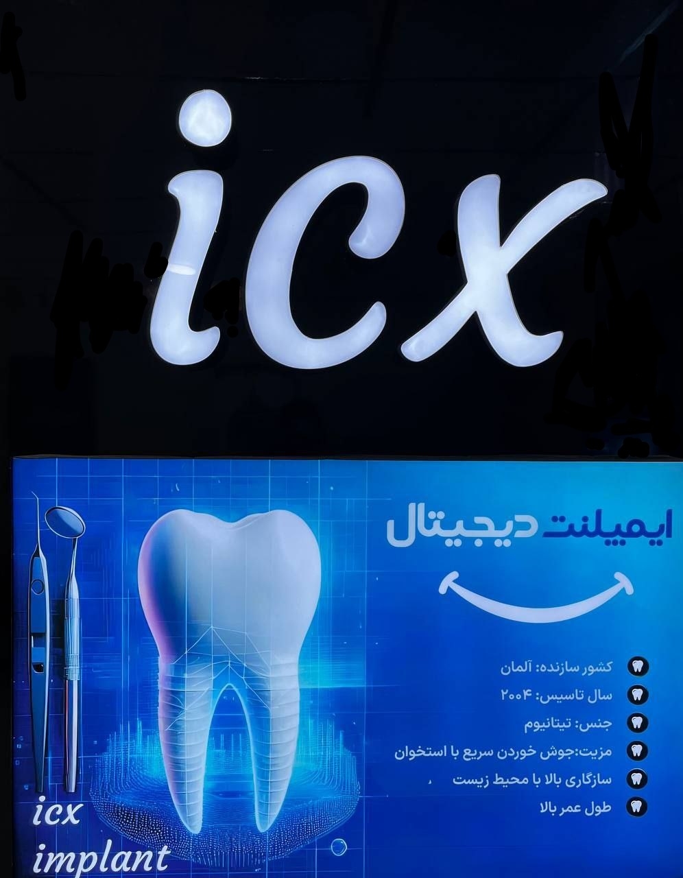 ایمپلنت دیجیتال و فوری در قم | کلینیک دندانپزشکی پارسیان 2 ایمپلنت نئو